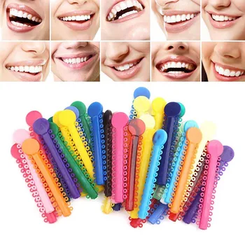 10 Vnt Lazdos 1Pack Dantų Ligatura ryšius Ortodontija Elastinės Gumos Juostos Įvairių Spalvų Karšta!