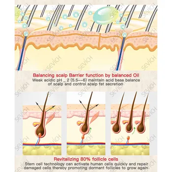 30ML SEVICH Plaukų Slinkimas Produktų Plaukų lakas Gamtos Jokio Šalutinio Poveikio, Plaukai Greičiau Atauga Esmė Plaukų Augimą Produktai, Plaukų Priežiūra