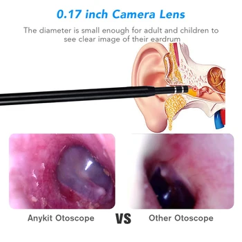 Naujas HD Daugiafunkcinis Medicinos Ausų Valymo Endoskopą Šaukštas Mini Kamera Ausies Picker Ausų Vaško Šalinimo Vaizdo Burną, Nosį Otoscope