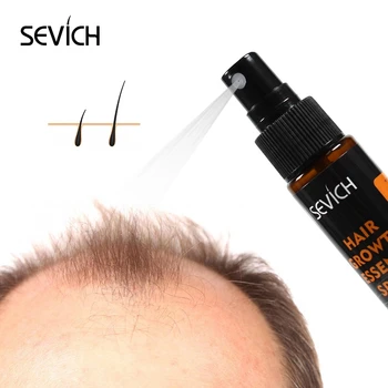 Sevich 30ml Augalai Esmė Plaukų Augimą purškiamas plaukų gydymo priemonė užkirsti kelią Plaukų Slinkimas Produktas, Plaukų Remonto Auga Greičiau