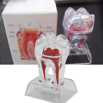 Stomatologas, Dantų Kristalų Bazės Kieto Plastiko Dantų Krūminių Dantų Modelis Atskirti