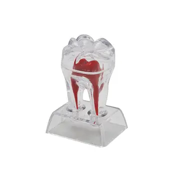 Stomatologas, Dantų Kristalų Bazės Kieto Plastiko Dantų Krūminių Dantų Modelis Atskirti